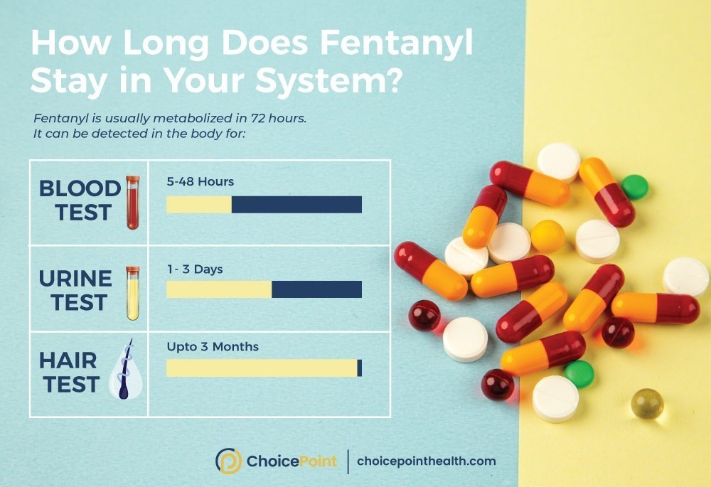 How Long Do The Effects of Fentanyl Last?
