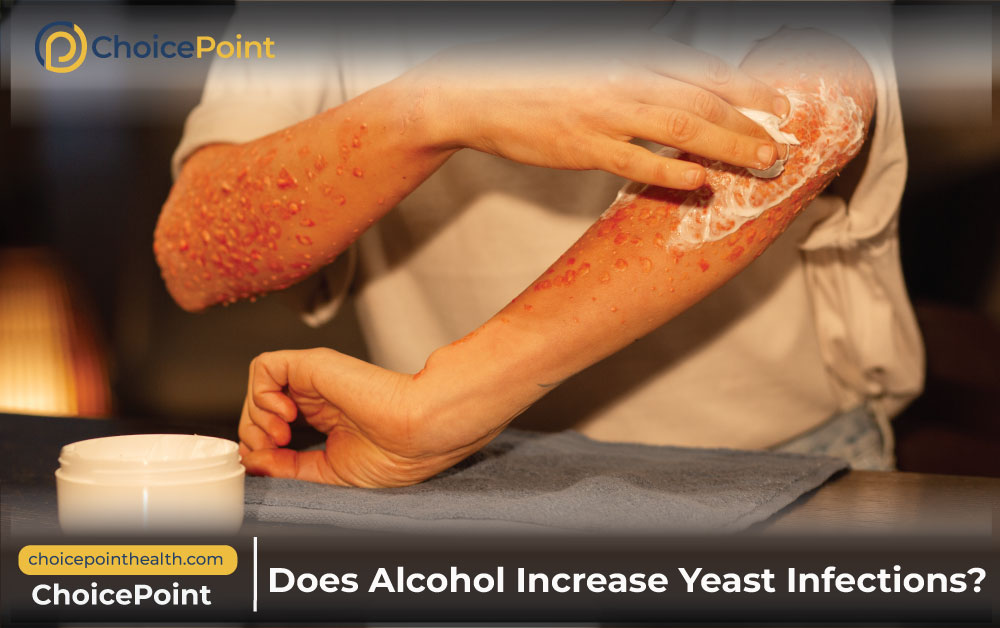 Does Alcohol Make Yeast Infection Worse