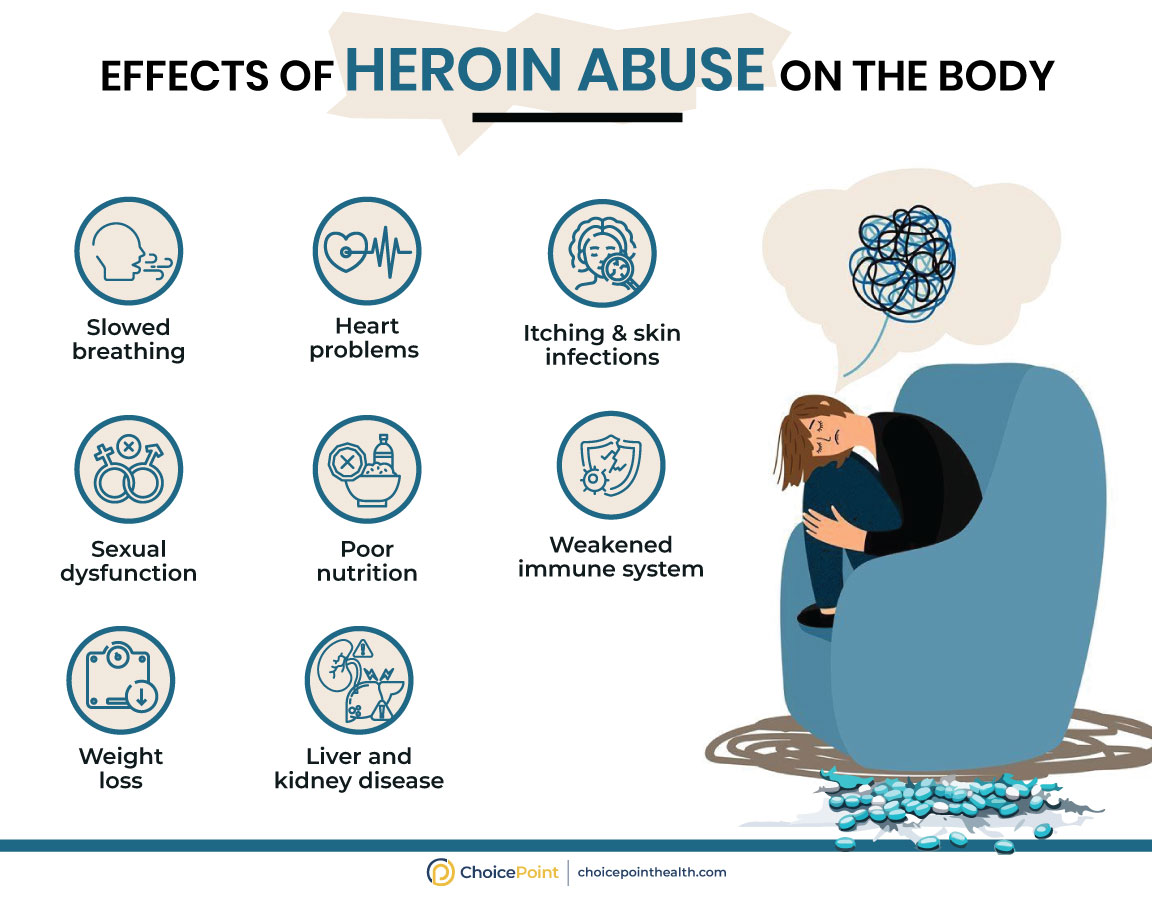 Heroin Abuse Side Effects