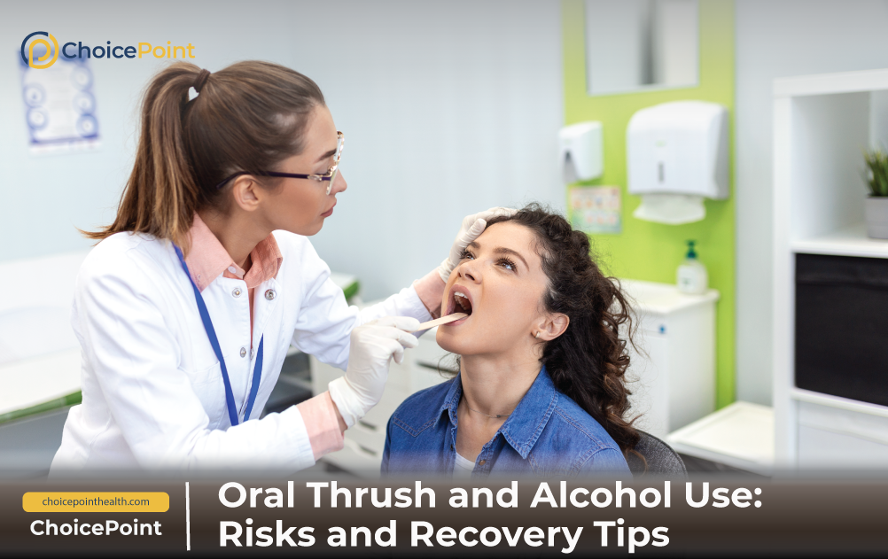 Alcohol-associated oral fungal infection Oral candidiasis in drinkers